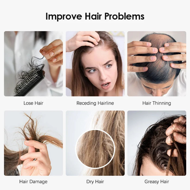 Electric Hair Growth Comb Red Blue Light Therapy Anti Hair Loss Massage Comb High-frequency Vibration Head Massage Hair Brush