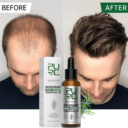 Hair Growth Rosemary Oil