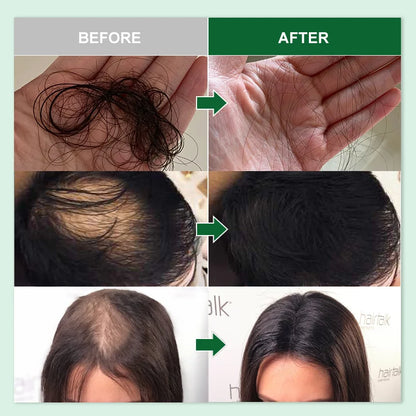 Hair Growth Rosemary Oil